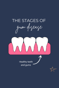 Cartoon graphic of gums and 3 teeth showing an example of healthy teeth and gums