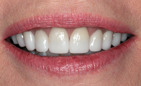 Dr. Brian LeSage Dentist Smile Gallery