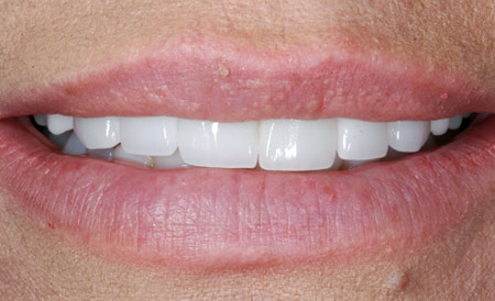 Dr. Brian LeSage Dentist Smile Gallery