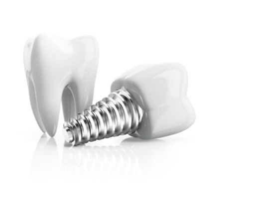 Dental implant and crown