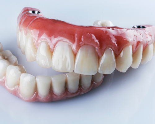 A palateless denture and a lower denture