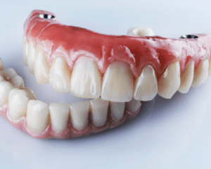 Hybrid upper and lower dentures